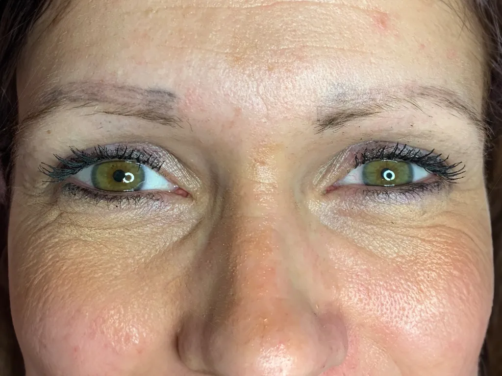 Microblading-Alternative - Augenbrauentransplantation Muster