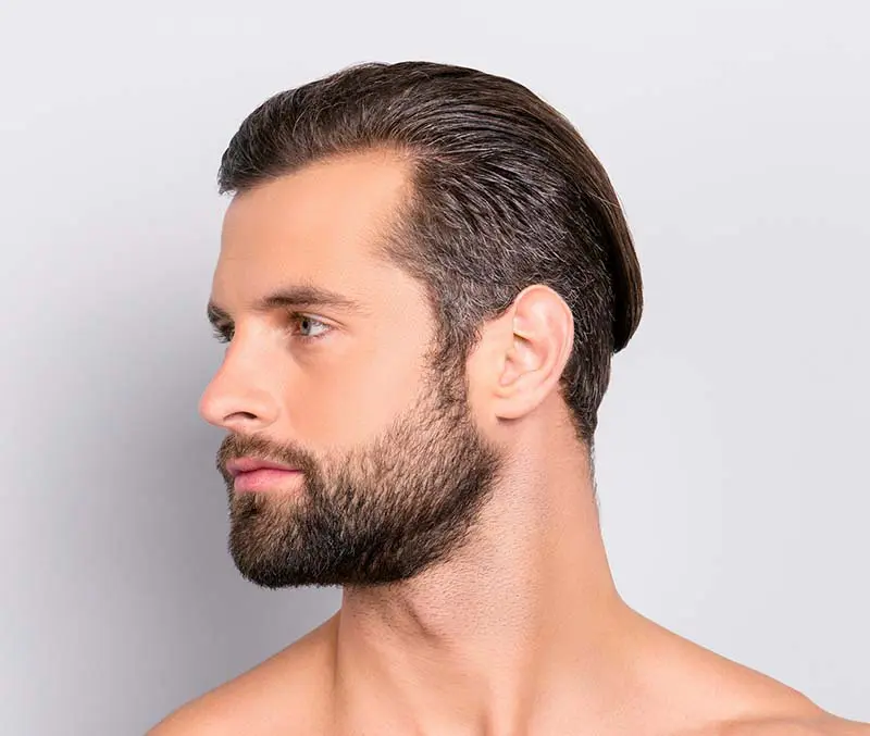 Barthaartransplantation in der Dion Hair Clinic - Verdichtung und Neugestaltung des Bartwuchses für einen volleren Bart